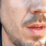 HAOS – Naš Popularni Pjevač Hospitalizovan, Priznao Šta Se Dešava – Objavio Je Fotografiju, A Užasno Izgleda