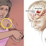 OVO SU JEZIVI SIMPTOMI da ste vjerovatno imali tihi MOŽDANI UDAR i da vas uskoro čeka i drugi