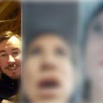 Prošla kroz pakao: Napumpala usne pa sve eksplodiralo – SVI BJEŽE OD MENE KAO DA SAM GUBAVA